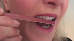 Disturbing trend: Younger people using nail files on teeth
