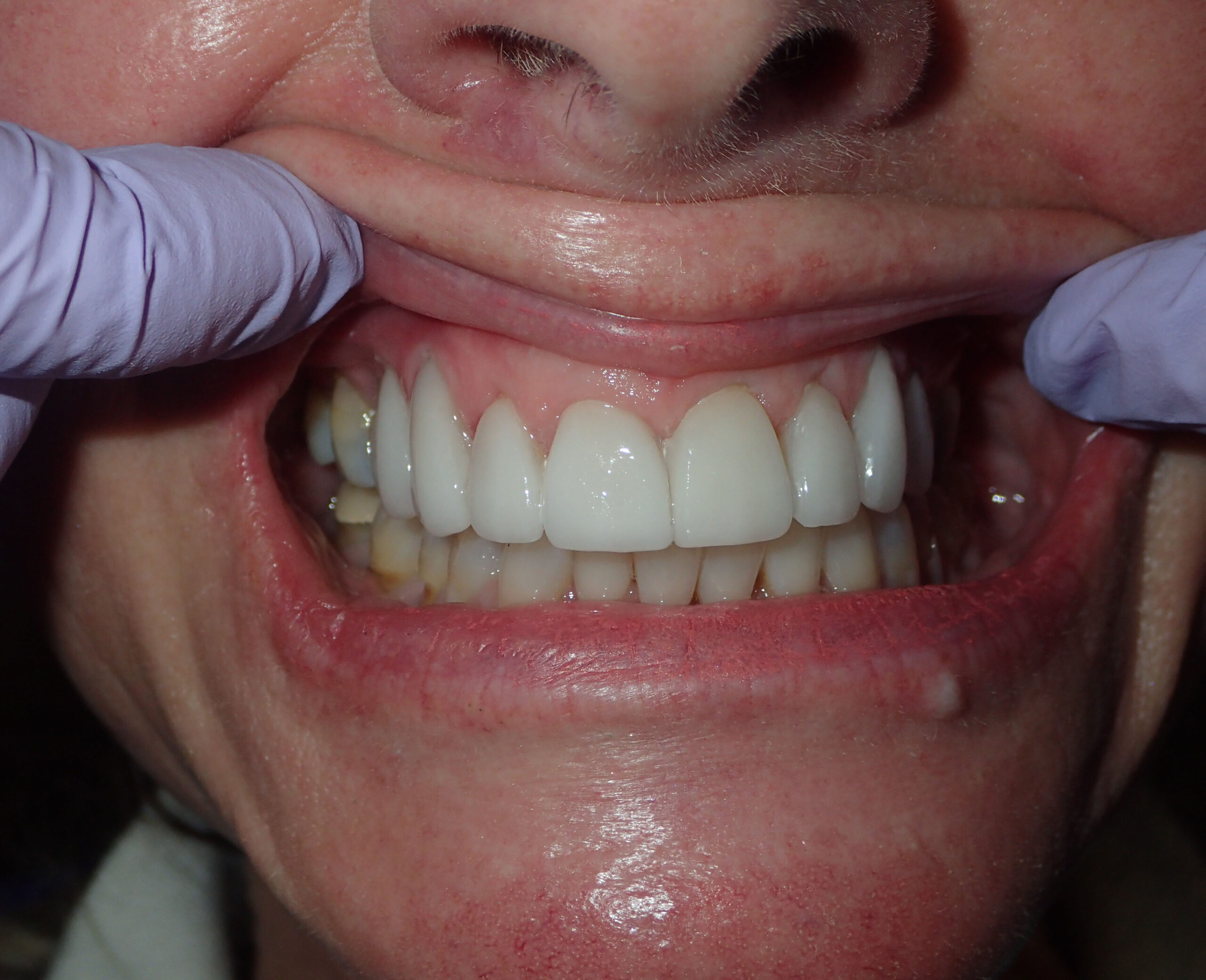 Dalin Dental Associates - Before and After