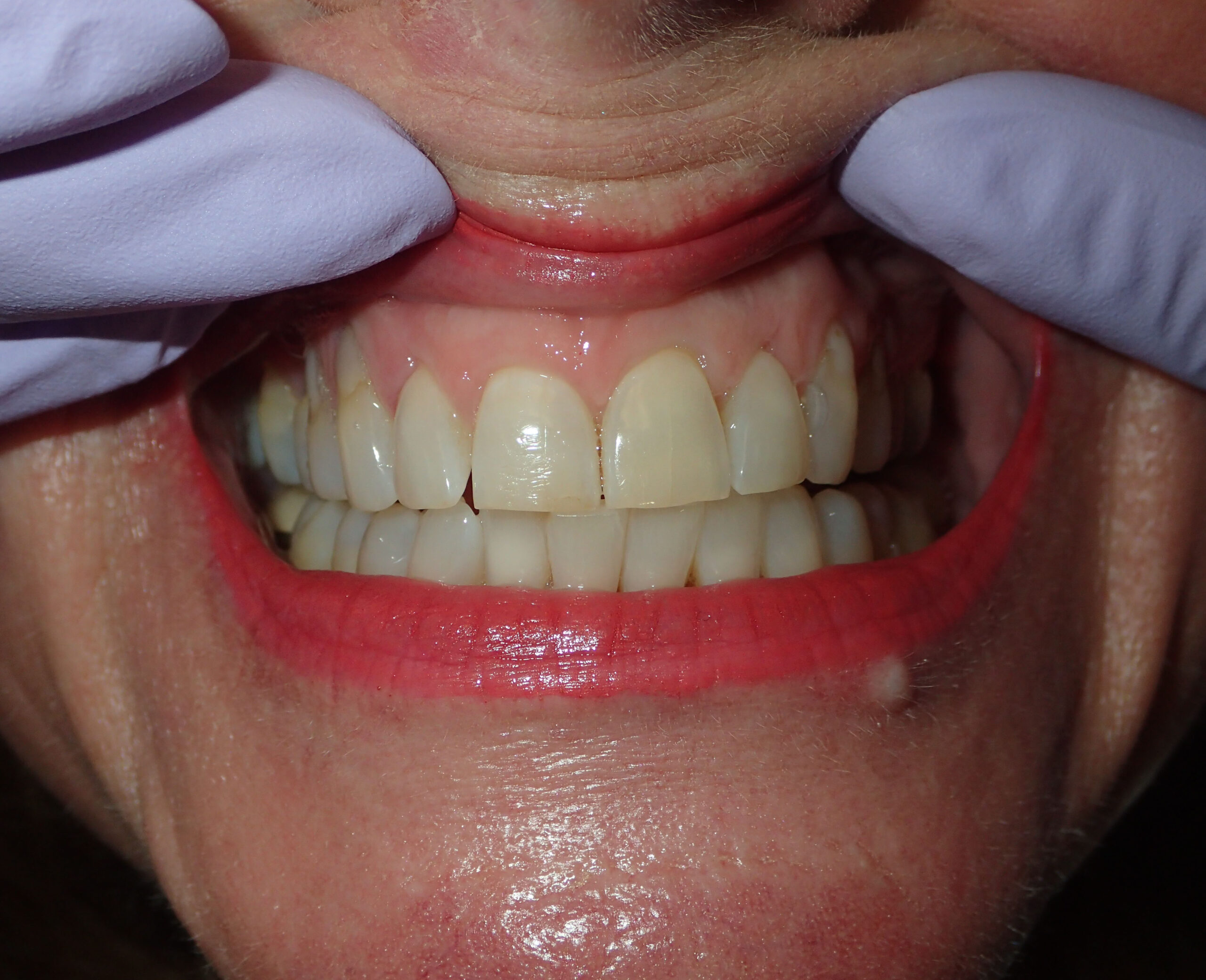 Dalin Dental Associates - Before and After